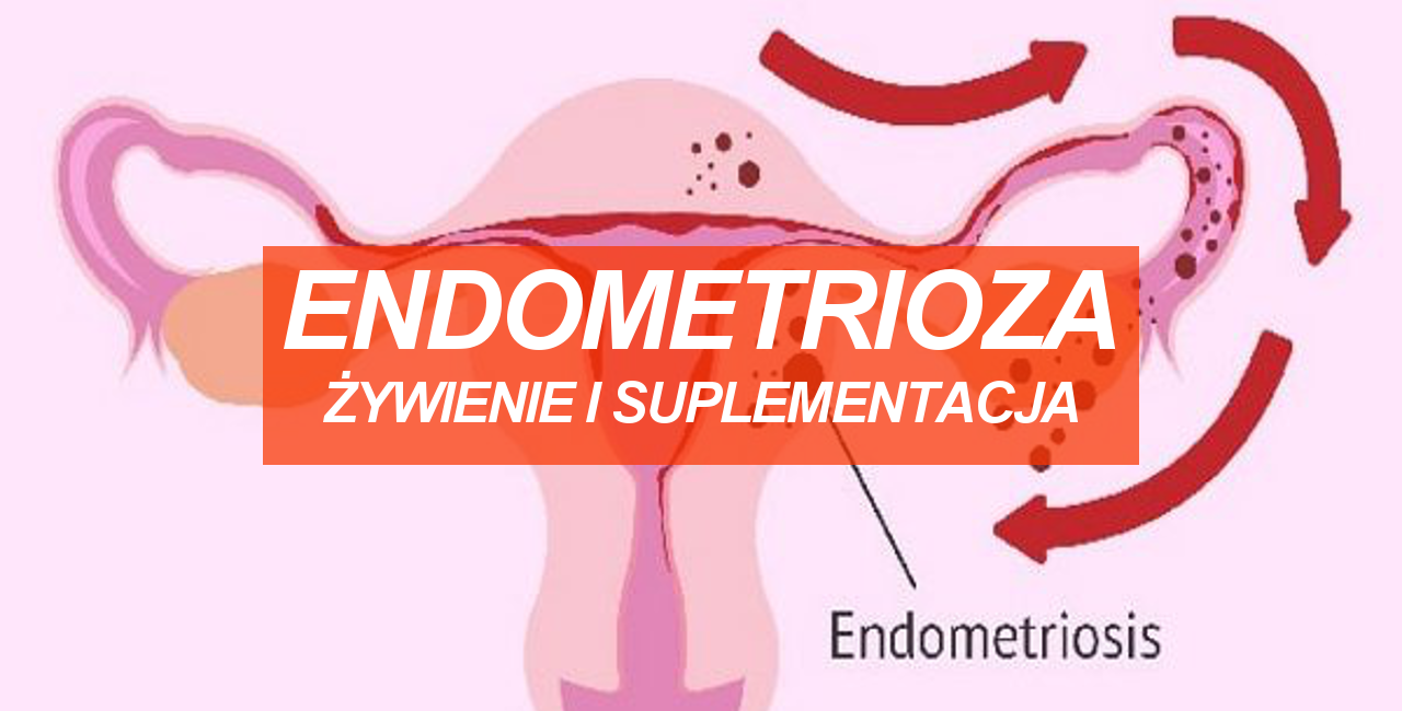 Endometrioza żywienie I Suplementacja Wiedza 7439