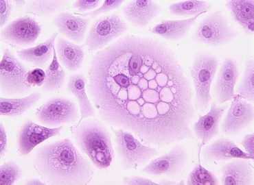 Terapia komórkami macierzystymi – czym jest?