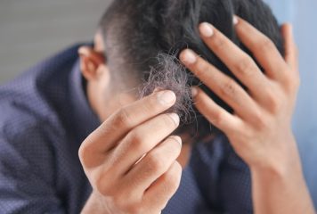 Stosowanie testosteronu a utrata włosów u sportowców