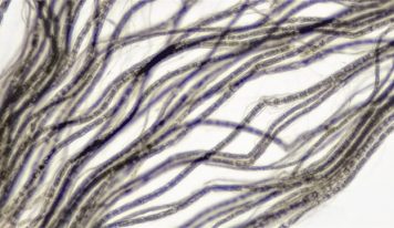 Stymulacja nerwu błędnego – jakie ma działania?