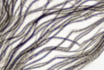 Stymulacja nerwu błędnego – jakie ma działania?