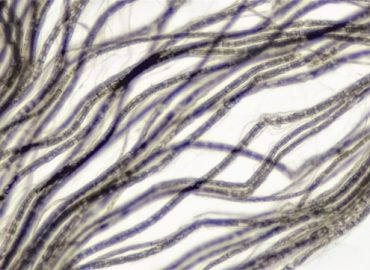 Stymulacja nerwu błędnego – jakie ma działania?