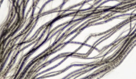 Stymulacja nerwu błędnego – jakie ma działania?