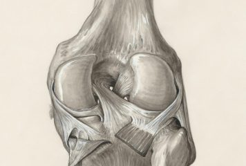 Zanik mięśni po rekonstrukcji ACL – żywienie