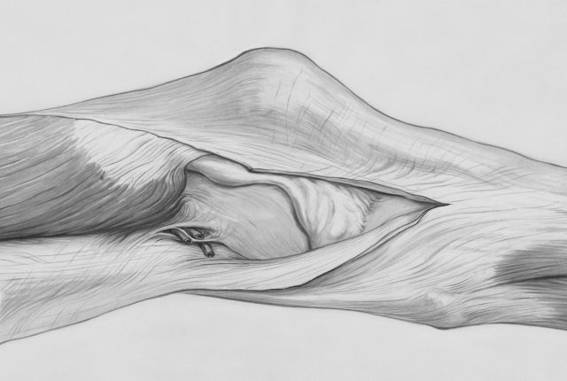 Trening w tendinopatii – podstawy i praktyka