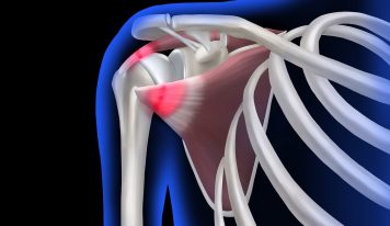 Podstawowa edukacja w tematyce kontuzji dla zawodu trenera personalnego