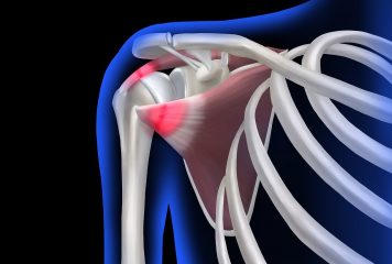 Podstawowa edukacja w tematyce kontuzji dla zawodu trenera personalnego